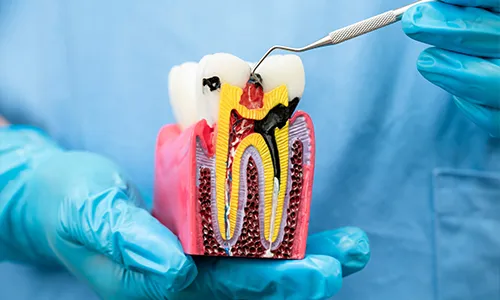 Endodontics